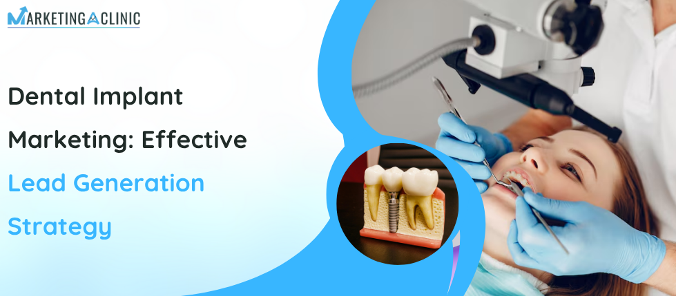dental implants marketng