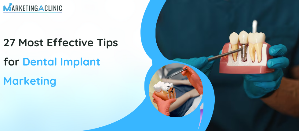 dental implant marketing strategies